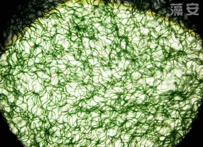 螺旋藻对于患有便秘的人,具有奇效